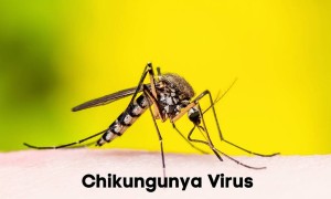 基孔肯雅热的6种自然家庭疗法，很多人都不知道