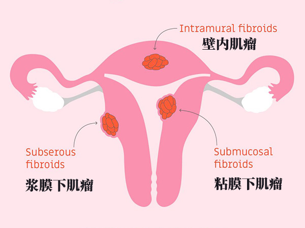 例假肚子疼怎么缓解最有效