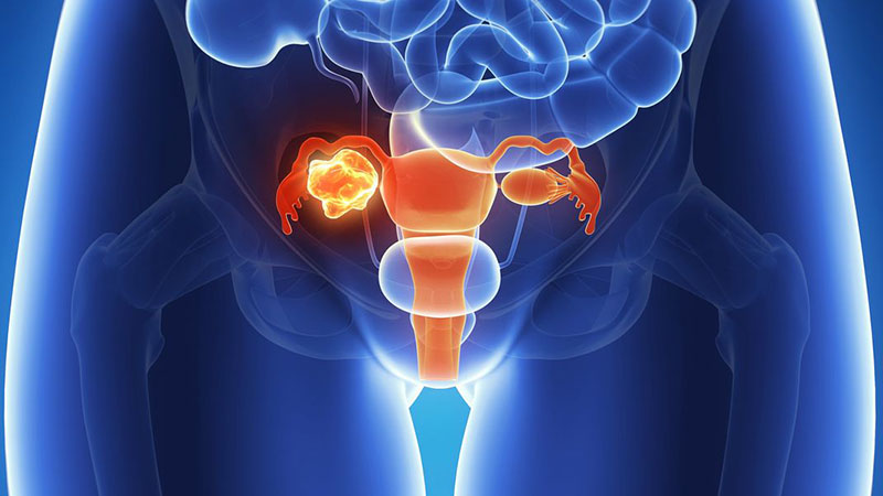 女性多生宝宝得子宫肌瘤的概率会降低吗为什么
