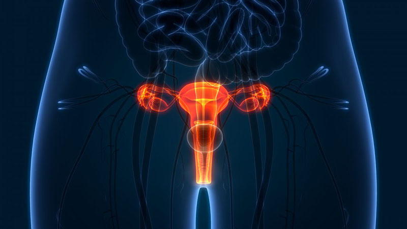 子宫内膜异位症导致患子宫内膜癌的几率有多高多大
