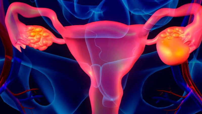 如何防止子宫内膜异位症复发发生的方法有哪些