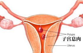 子宫息肉月经不调吃了雌激素可以吗会怀孕吗