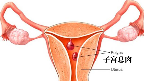 子宫息肉月经不调吃了雌激素可以吗会怀孕吗
