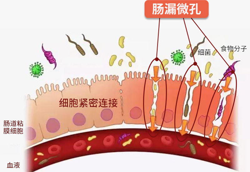 桥本氏病是什么病症能治好吗吃什么药